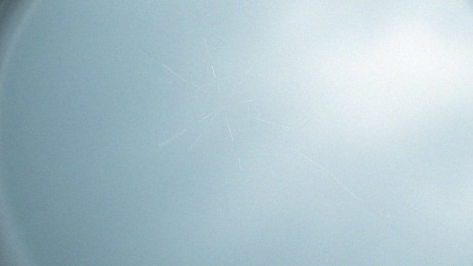 Uszkodzona rogówka oka objawy – jak je rozpoznać?